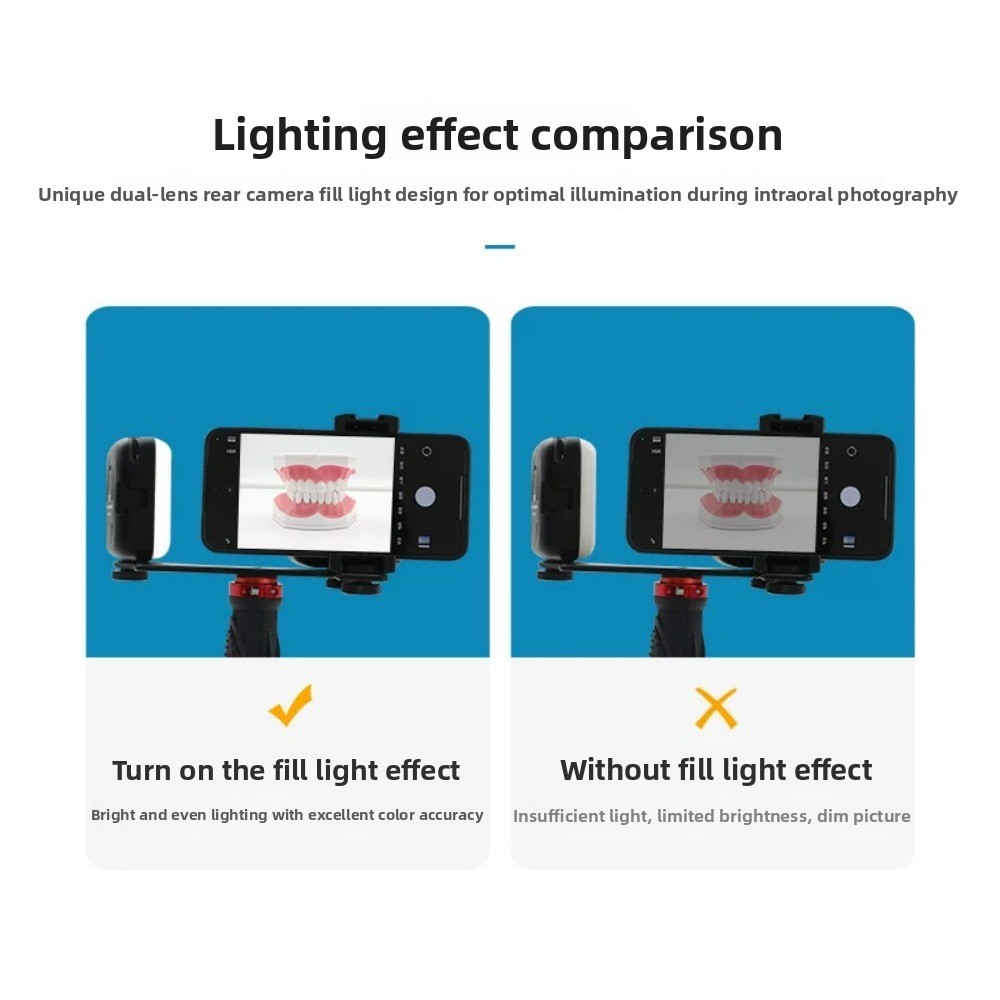 Dental Photography Light, Blue - огляд і ціна Photography Lighting Kits